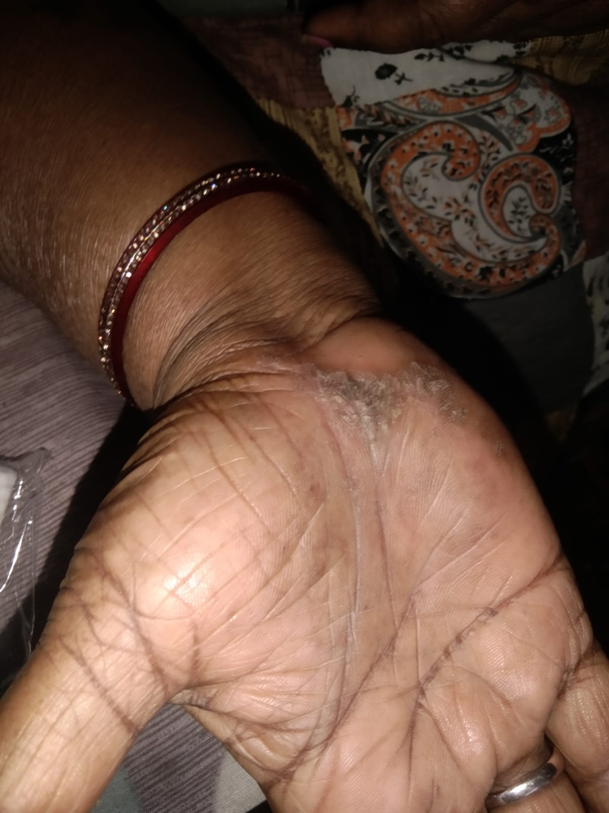 After Treatment