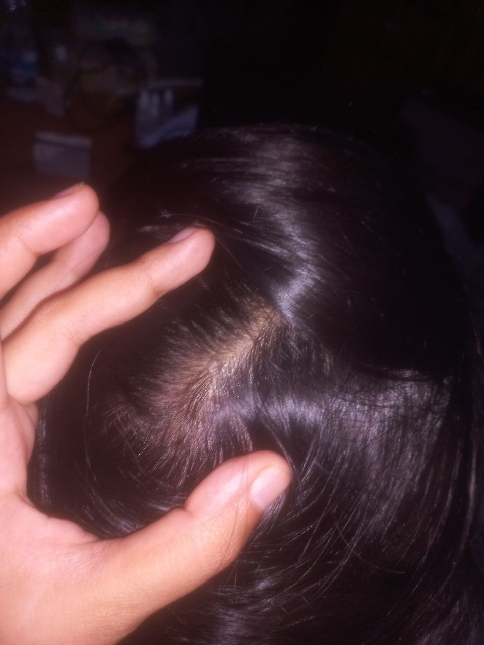 After Treatment