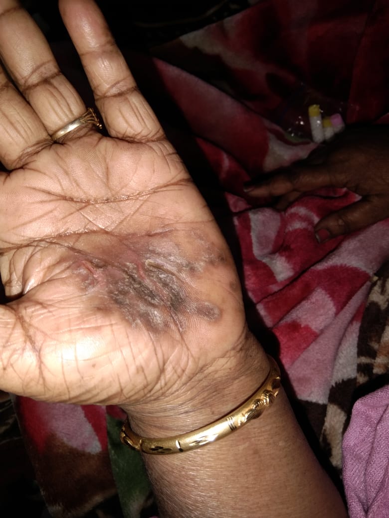 Before Treatment