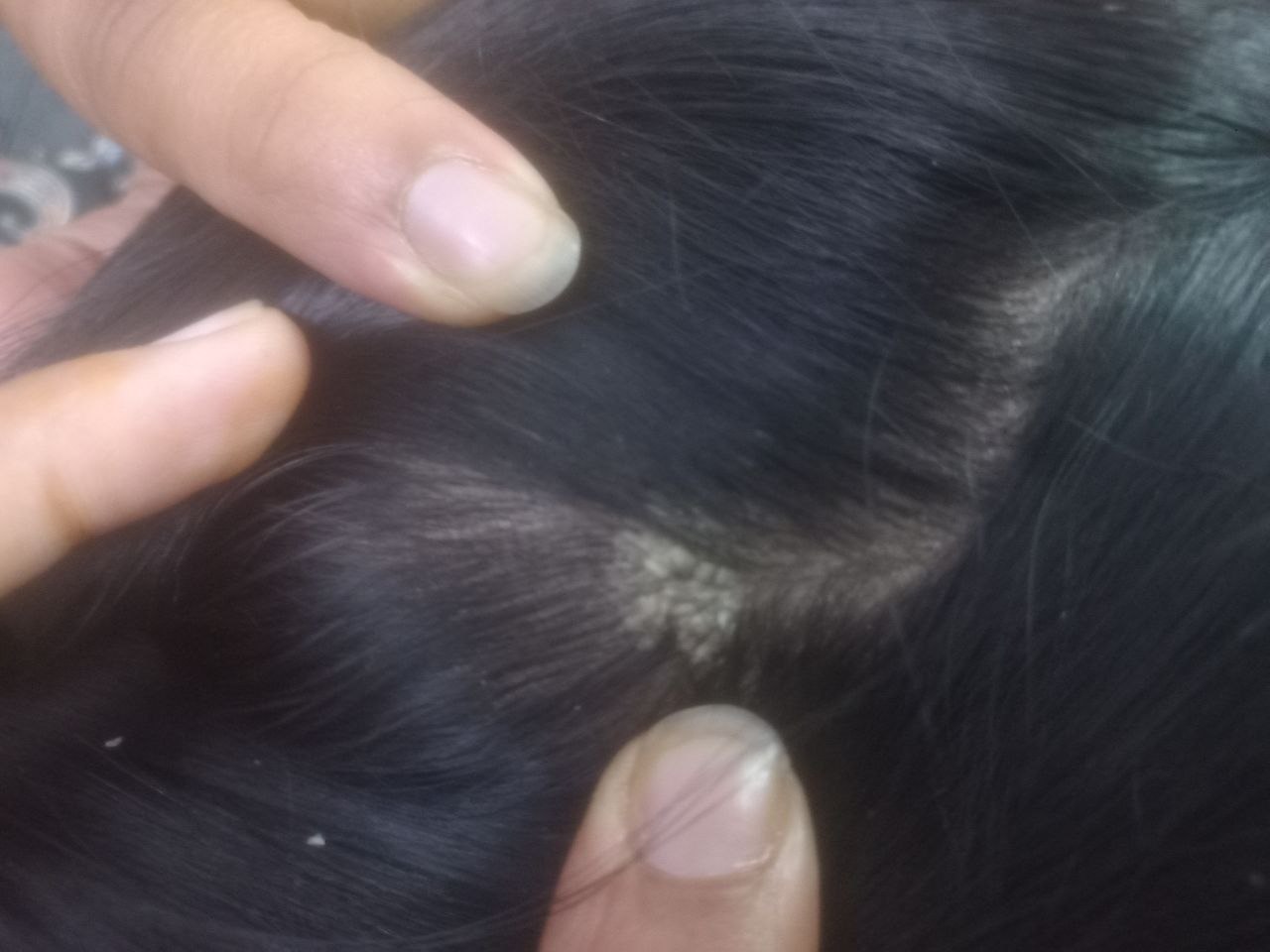 Before Treatment